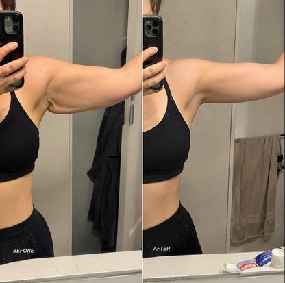 Firm Loose Skin With The FirmaSculpt™ 4-in-1